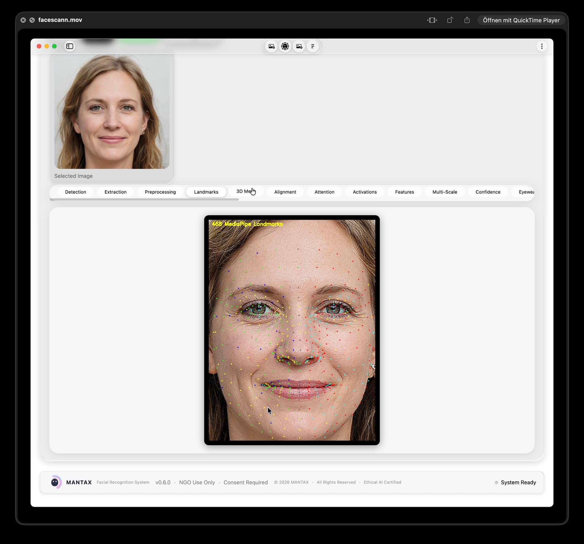 Landmark Detection